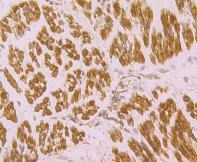 CACNG1 Antibody in Immunohistochemistry (Paraffin) (IHC (P))