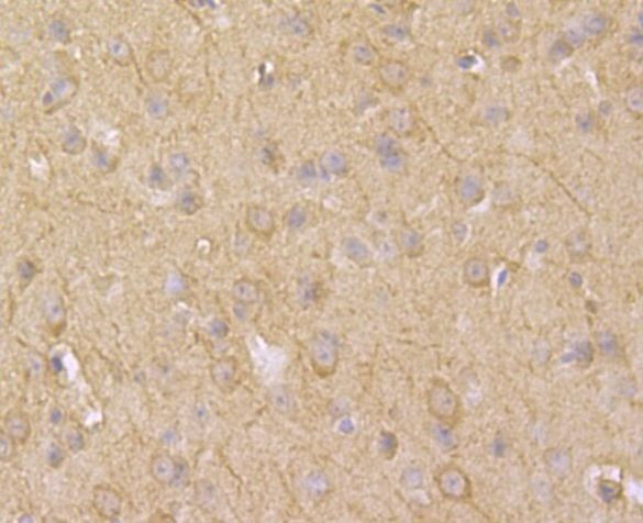 ASIC1 Antibody in Immunohistochemistry (Paraffin) (IHC (P))