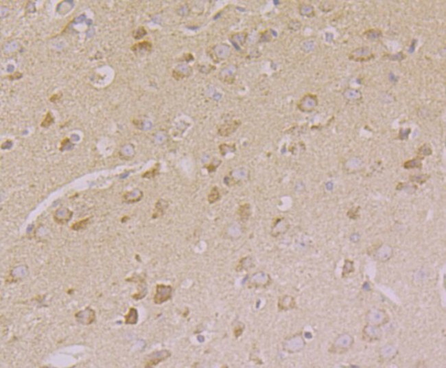 CNGA2 Antibody in Immunohistochemistry (Paraffin) (IHC (P))