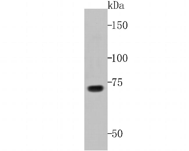 Hemagglutinin-Neuraminidase Antibody in Western Blot (WB)
