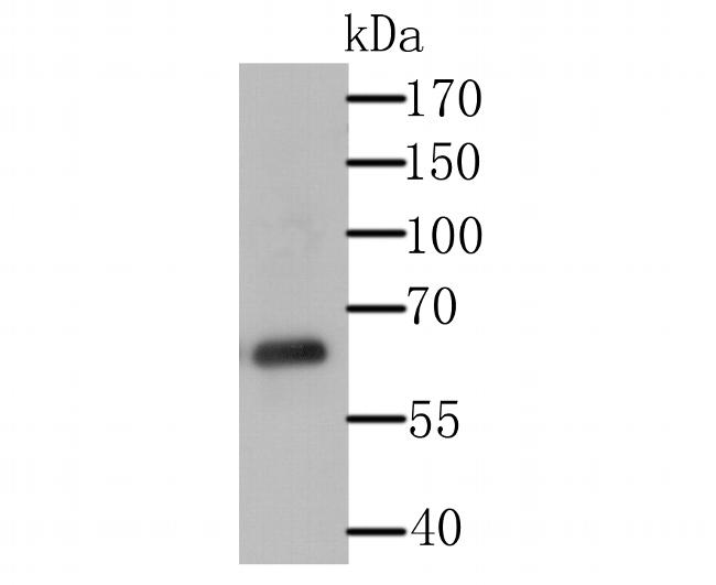 USP14 Antibody in Western Blot (WB)