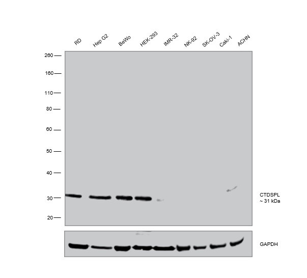 CTDSPL Antibody in Western Blot (WB)