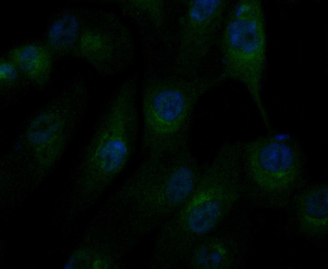 alpha Actinin 1 Antibody in Immunocytochemistry (ICC/IF)