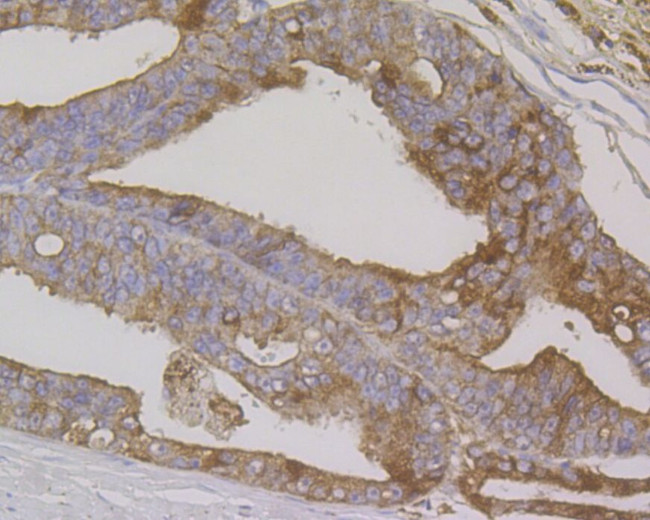 Cytokeratin 7 Antibody in Immunohistochemistry (Paraffin) (IHC (P))