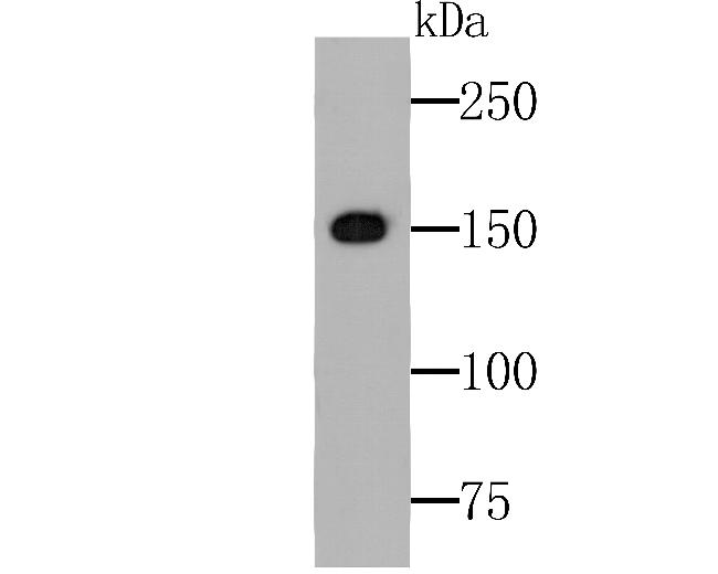 TRPA1 Antibody in Western Blot (WB)