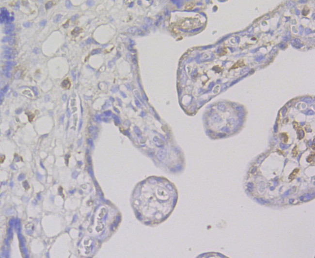 CD163 Antibody in Immunohistochemistry (Paraffin) (IHC (P))