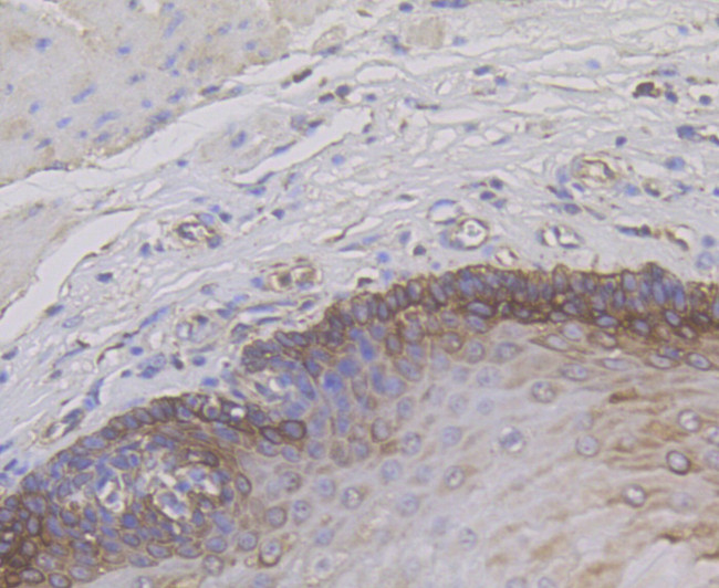 Cytokeratin 14 Antibody in Immunohistochemistry (Paraffin) (IHC (P))