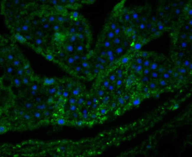 LOC4327476 Antibody in Immunohistochemistry (Paraffin) (IHC (P))