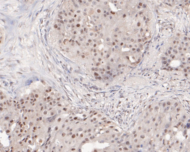 SSRP1 Antibody in Immunohistochemistry (Paraffin) (IHC (P))