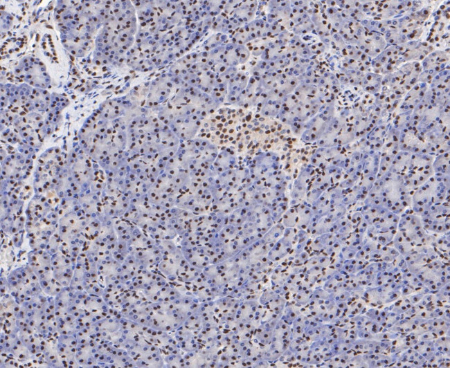 SSB Antibody in Immunohistochemistry (Paraffin) (IHC (P))