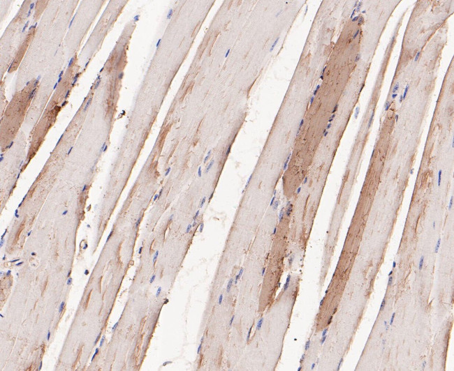 Myoglobin Antibody in Immunohistochemistry (Paraffin) (IHC (P))