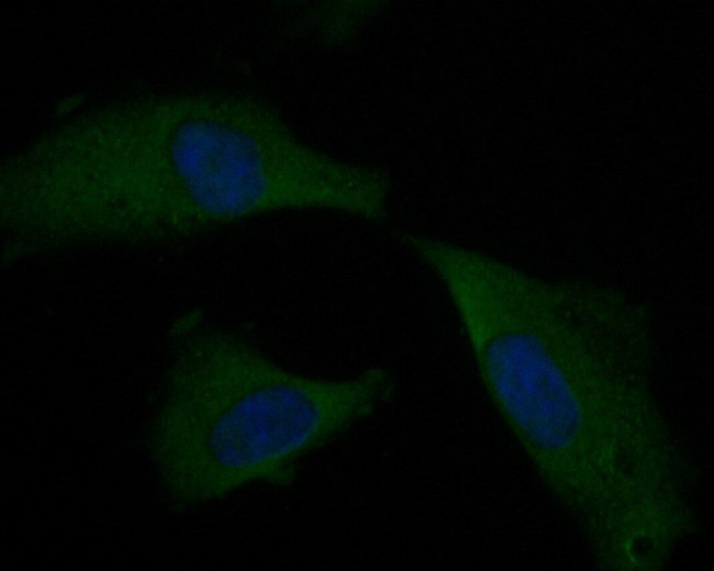 KVbeta1 (KCNAB1) Antibody in Immunocytochemistry (ICC/IF)