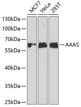 Aladin Antibody in Western Blot (WB)
