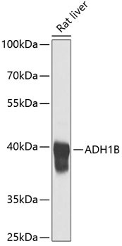 ADH1B Antibody in Western Blot (WB)