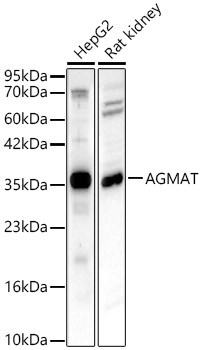 AGMAT Antibody in Western Blot (WB)
