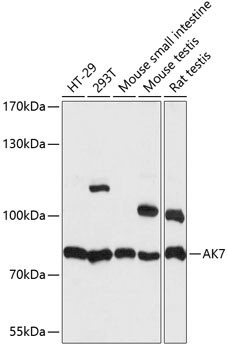 Adenylate Kinase 7 Antibody in Western Blot (WB)