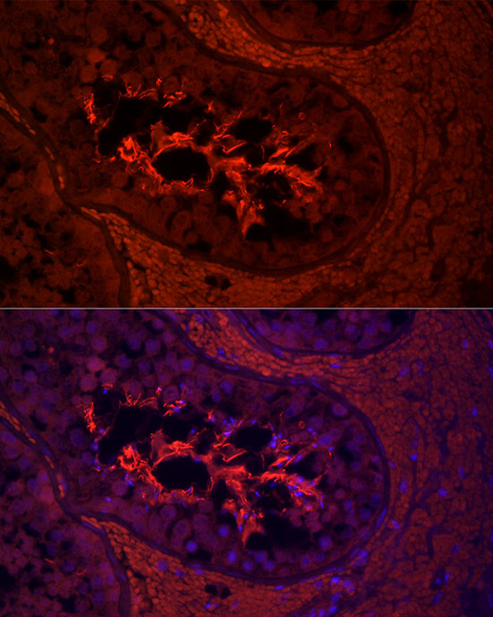 AKAP4 Antibody in Immunocytochemistry (ICC/IF)