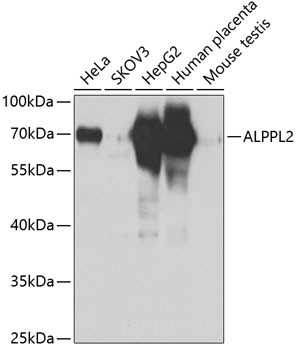 ALPPL2 Antibody in Western Blot (WB)