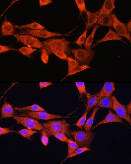 AMT Antibody in Immunocytochemistry (ICC/IF)