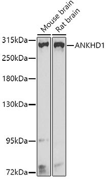 ANKHD1 Antibody in Western Blot (WB)