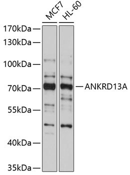 ANKRD13A Antibody in Western Blot (WB)
