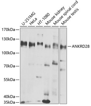 ANKRD28 Antibody in Western Blot (WB)