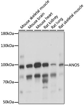 ANO5 Antibody in Western Blot (WB)