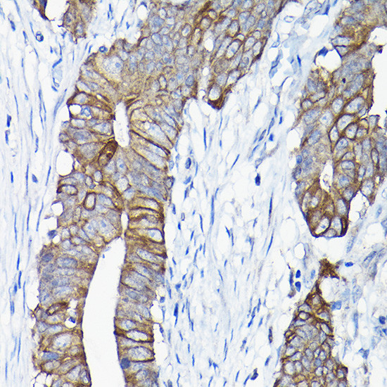 Annexin A13 Antibody in Immunohistochemistry (Paraffin) (IHC (P))