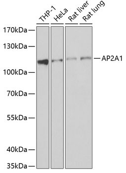 AP2A1 Antibody in Western Blot (WB)