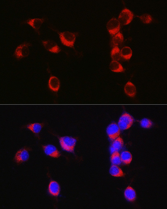APLP1 Antibody in Immunocytochemistry (ICC/IF)