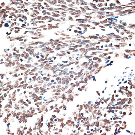 AQR Antibody in Immunohistochemistry (Paraffin) (IHC (P))