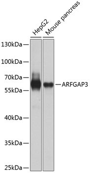 ARFGAP3 Antibody in Western Blot (WB)