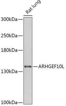 ARHGEF10L Antibody in Western Blot (WB)