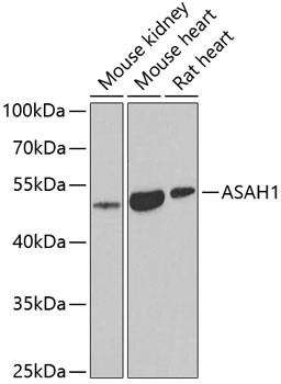 ASAH1 Antibody in Western Blot (WB)