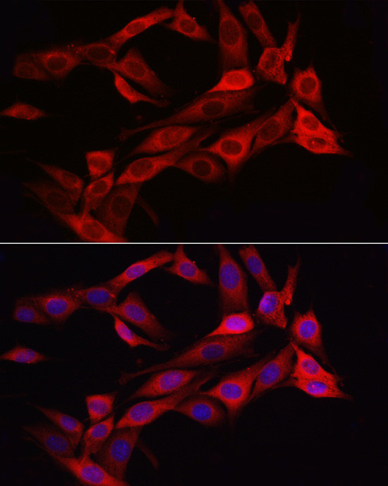 Asparagine Synthetase Antibody in Immunocytochemistry (ICC/IF)