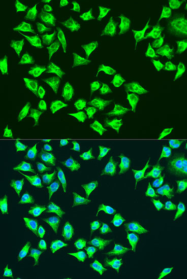 MT-ATP6 Antibody in Immunocytochemistry (ICC/IF)