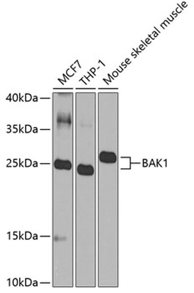 BAK1 Antibody in Western Blot (WB)