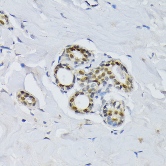 BCCIP Antibody in Immunohistochemistry (Paraffin) (IHC (P))