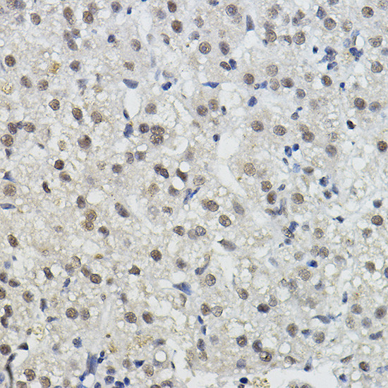 BRAP Antibody in Immunohistochemistry (Paraffin) (IHC (P))