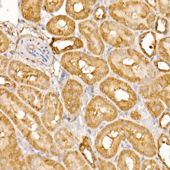 BTNL2 Antibody in Immunohistochemistry (Paraffin) (IHC (P))