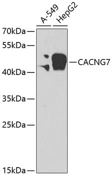 CACNG7 Antibody in Western Blot (WB)