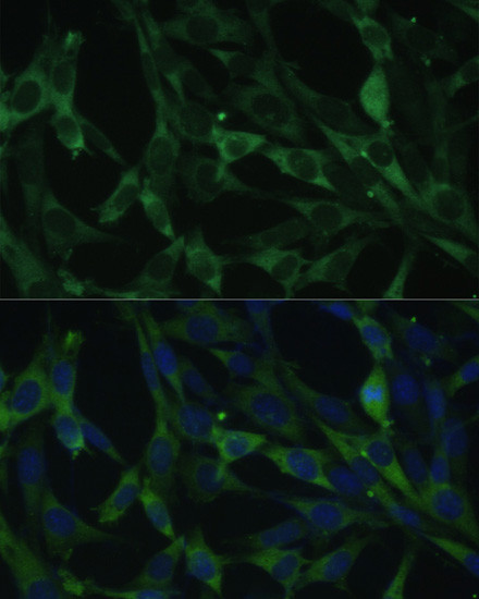 CALU Antibody in Immunocytochemistry (ICC/IF)