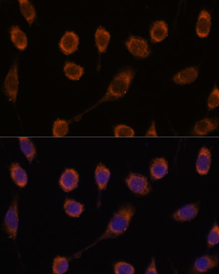 CCT6B Antibody in Immunocytochemistry (ICC/IF)