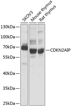 CDKN2AIP Antibody in Western Blot (WB)