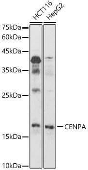 CENPA Antibody in Western Blot (WB)