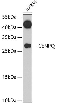 CENPQ Antibody in Western Blot (WB)