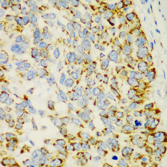 CHIA Antibody in Immunohistochemistry (Paraffin) (IHC (P))