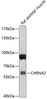 CHRNA2 Antibody in Western Blot (WB)