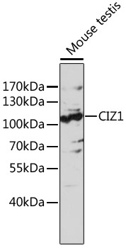 CIZ1 Antibody in Western Blot (WB)