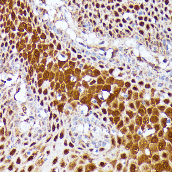 CLNS1A Antibody in Immunohistochemistry (Paraffin) (IHC (P))